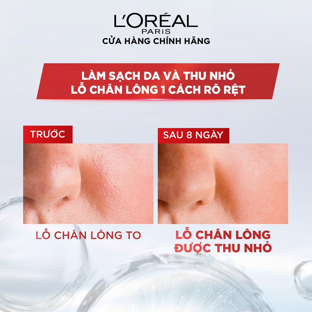 Nước Tẩy Trang L'Oréal Paris Revitalift Crystal Purifying Micellar Water Dành Cho Da Dầu 400ml
